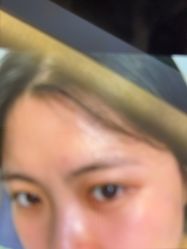 -长沙雅美医疗美容医院