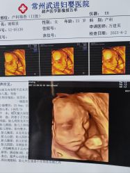 -常州武进妇婴医院