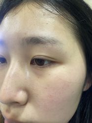 体验前-重庆联合丽格第五医疗美容医院