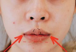 -SKINIST丽铂医疗美容