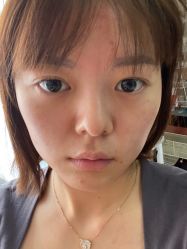 体验后-武汉颜范薇美医疗美容门诊部