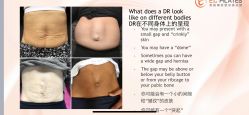 -意施精准塑形普拉提