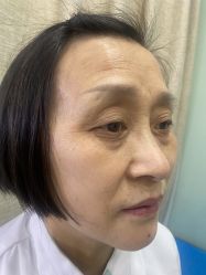 体验前-重庆联合丽格第五医疗美容医院