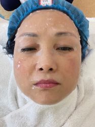体验后-禾丽康美医疗美容医院