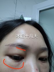 体验前-Yestar重庆艺星医疗美容医院
