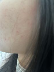 -美瑞莎创美医疗美容