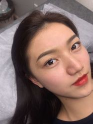 -丽美妍医疗美容·皮秒·立体分层抗衰