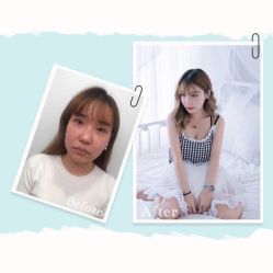 -洁铭新加坡医美