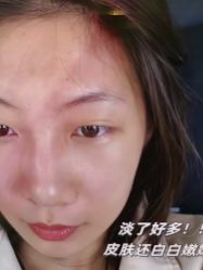-Yestar艺星整形美容医院