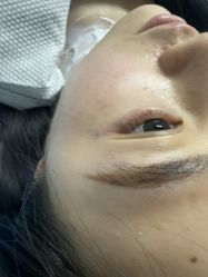 -长沙雅美医疗美容医院
