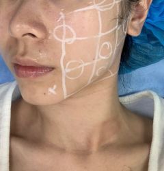 -广州美莱医疗美容医院