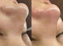 -美肤盾祛痘·问题肌头疗管理中心