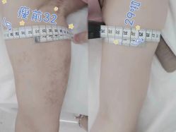 -Lily纤美·科技减脂中心