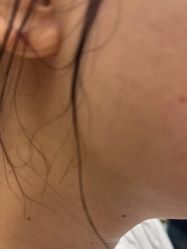 -美瑞莎创美医疗美容