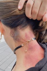 -松和日式美容整骨