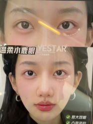 -Yestar艺星医疗美容医院