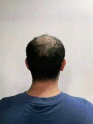 -发饰美男士增发补发假发定制店