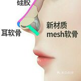 听说隆完鼻👃,不能🙅捏鼻子是真的吗?