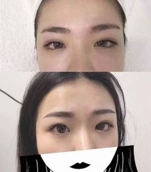 点击看大图 -瑾秀美肤·问题肌修护
