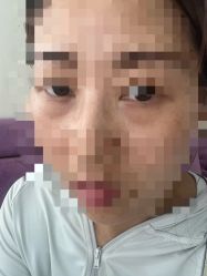 点击看大图 -广州美莱医疗美容医院