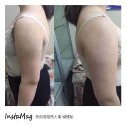 光SPA热力塑-光SPA科技美肤