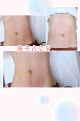 -Lily纤美·科技减脂中心