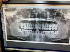 -天使口腔门诊部(上海店)