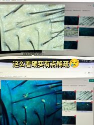 -雍禾植发全国连锁