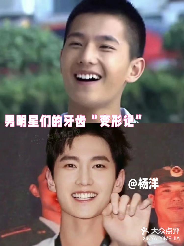 11:33 关注 杨洋的神颜离不开整齐洁白的一口好牙 #男明星们的牙齿