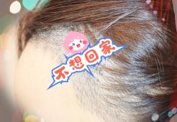 -大麦微针植发全国连锁