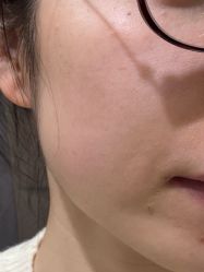 -宁波美莱整形美容