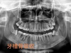 -团圆口腔·种植中心(锦江院区)