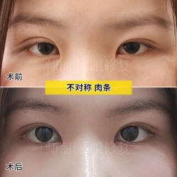 -丰联丽格医疗美容·联合丽格眼整形中心