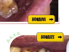 -圣贝口腔(海淀店)