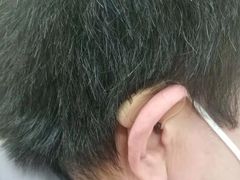 -海之声助听器无锡旗舰中心·儿童验配中心