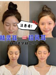 -上海时光整形外科医院