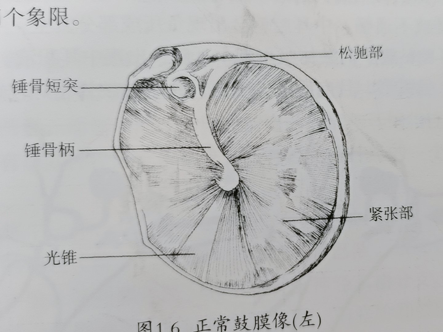 鼓膜四个象限解剖图图片