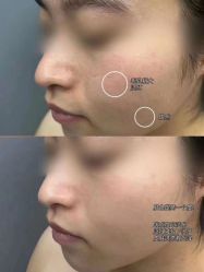 -LUNA皮相美·骨相美高级美感