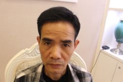 -大麦微针植发丨全国连锁