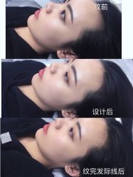 -OnFaer.纹眉半永久无创洗眉