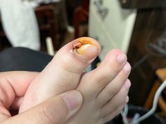 -新甲连锁灰指甲·甲沟炎·鸡眼(黑龙江路店)