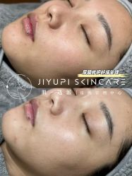 点击看大图 -MLP美丽派·问题肌疗愈中心