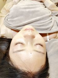 体验后-宥莉·ULLY 痘敏肌•科技皮肤管理中心
