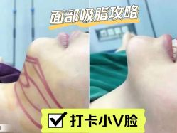 -昆明梦想医疗美容医院