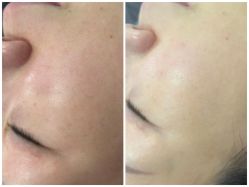 -SKIN79皮肤管理中心