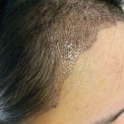 -熙朵美学植发连锁