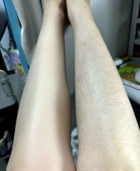 -薇兰专业脱毛连锁机构