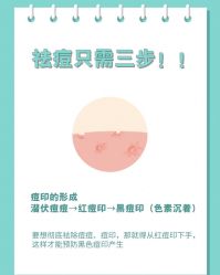 -苗方清颜痘肌研究所