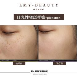 -丽美妍医疗美容·皮秒·立体分层抗衰