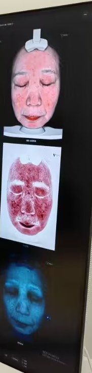体验前-张小熊连锁轻医美